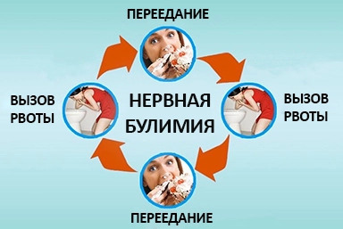 Лечение булимии в Черкассах